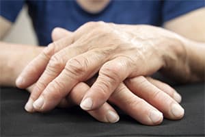 Arthritis Pain Relief with Hypnosis